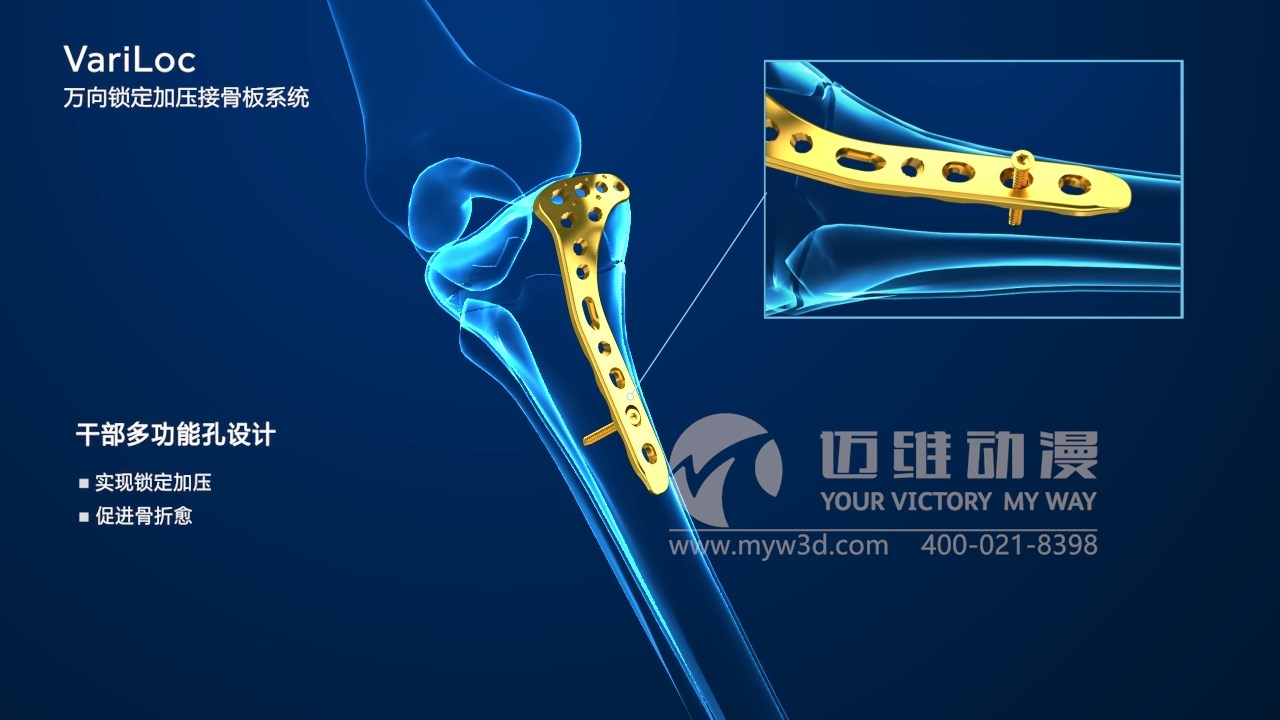 医学医疗三维动画