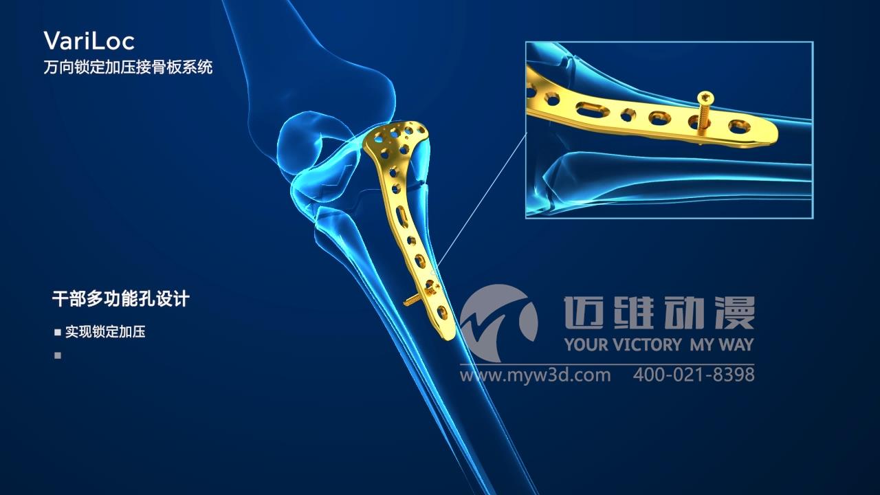 医疗器械三维动画.jpg