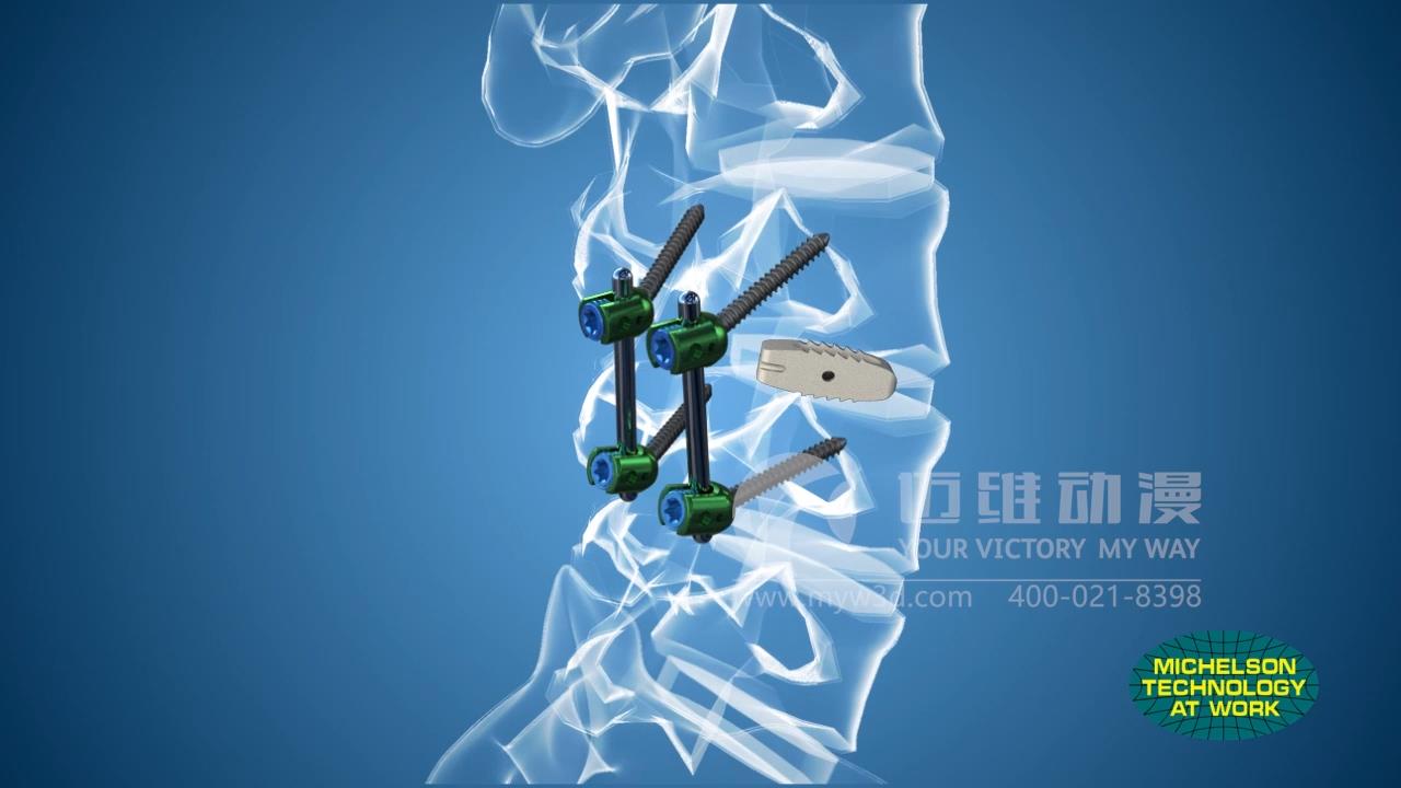医疗器械三维动画.jpg