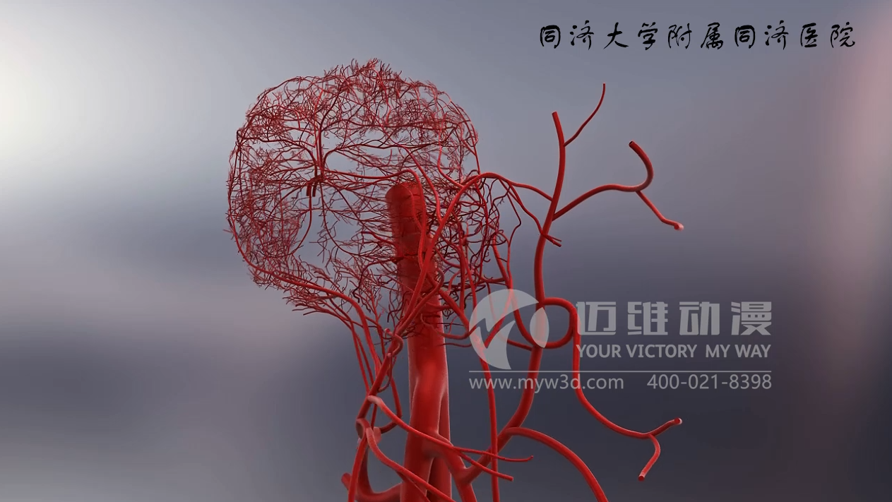 医疗三维动画制作.png