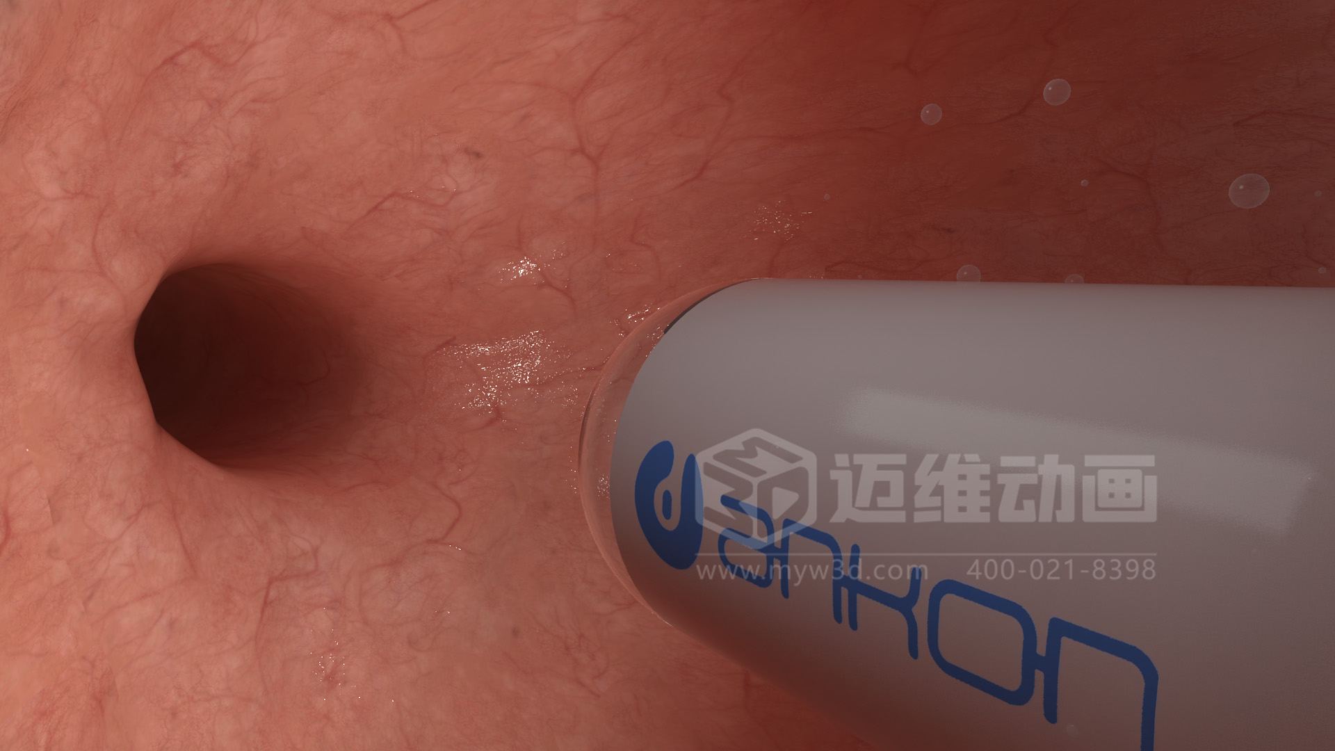医学检测设备如何突破消化道检查壁垒？三维动画还原核心技术与临床价值(图4)