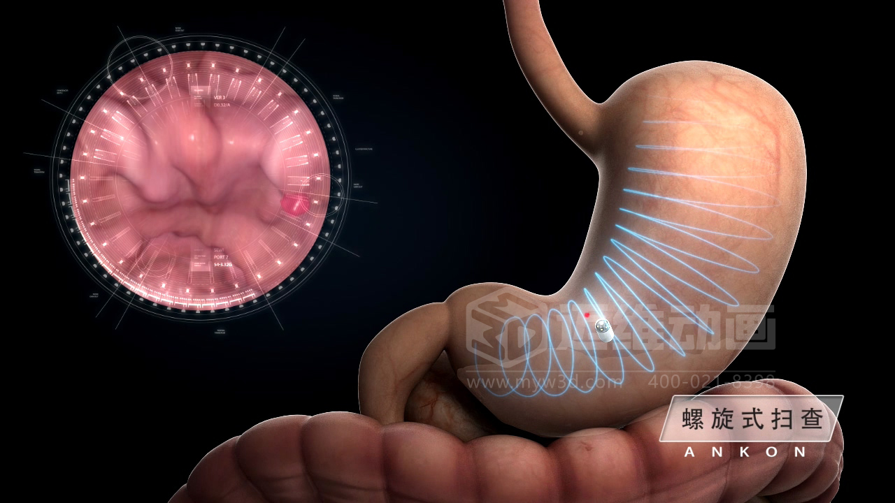 从 “看不懂” 到 “秒懂”，医学医疗三维动画凭什么兼顾专业度与传播力？(图5)